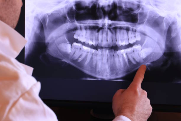 Best Dentist for Tooth Abscess  in Hurlburt Field, FL